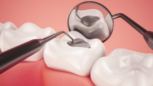 West Vancouver dentist Bel Canto Dental is an amalgam-free dental office